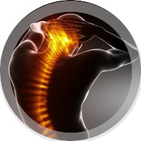  studio fisioterapico scanavino roberi torino   cervicalgia